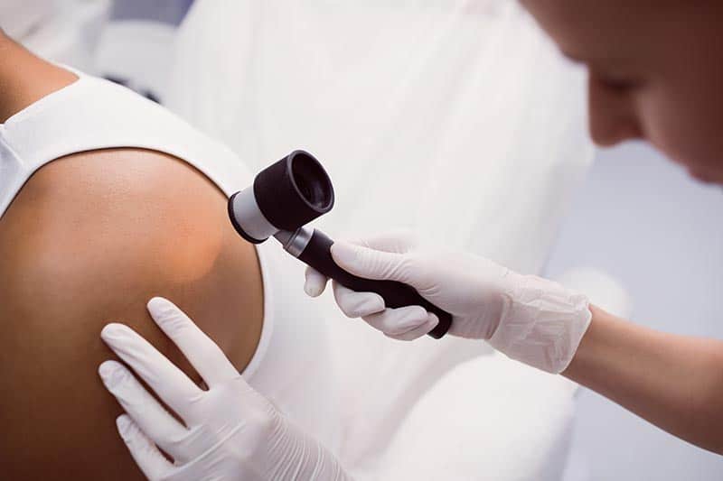 OCH Offers Free Skin Cancer Screenings